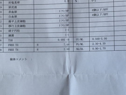 バセドウ病と思ったら検査は「何科」に行けば良いのか